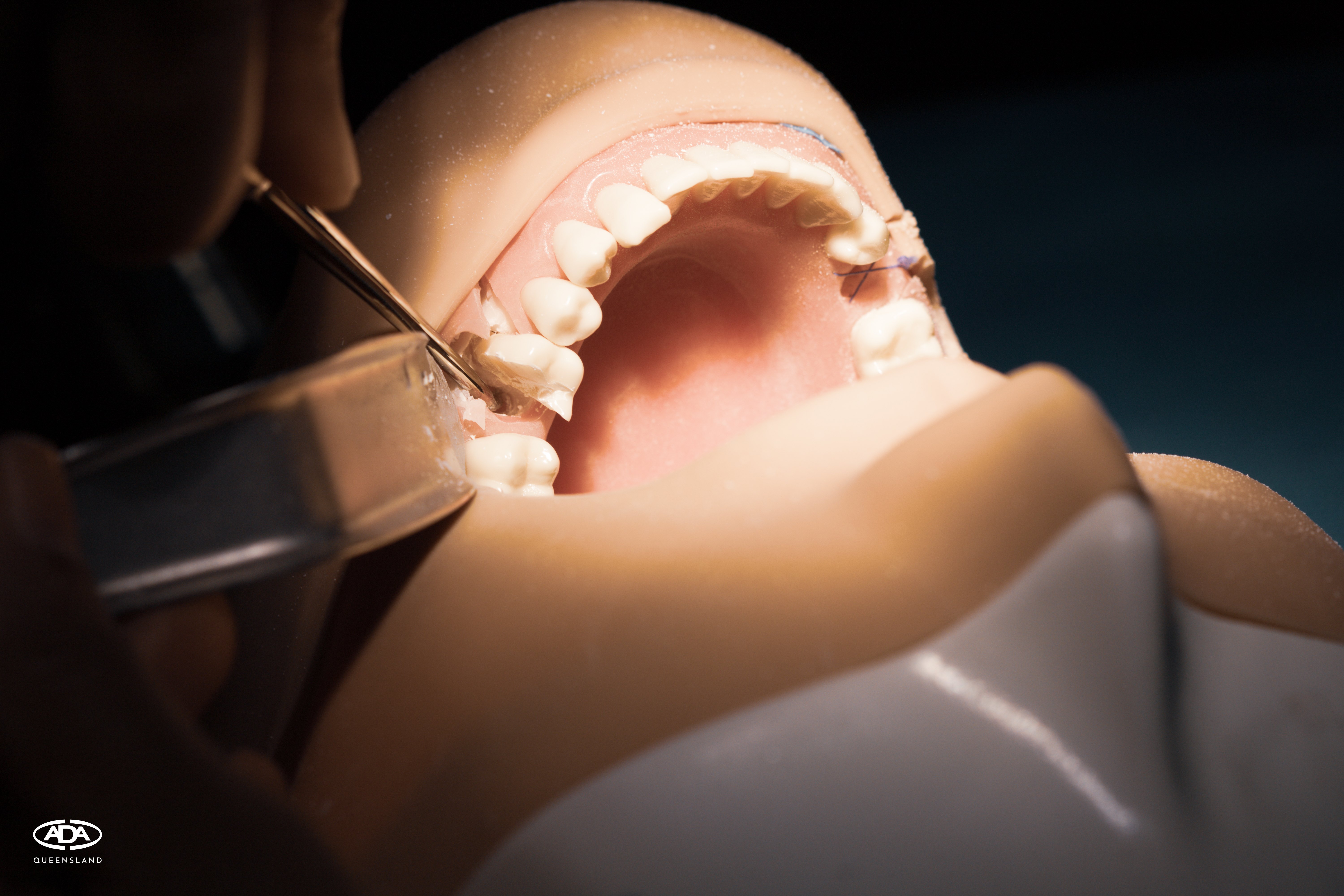 Oral Surgery Module 1
